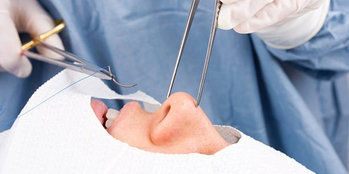 كيف أتعافى بسرعة بعد Rhinoplasty in Riyadh؟ خطوات بسيطة لنتيجة أسرع