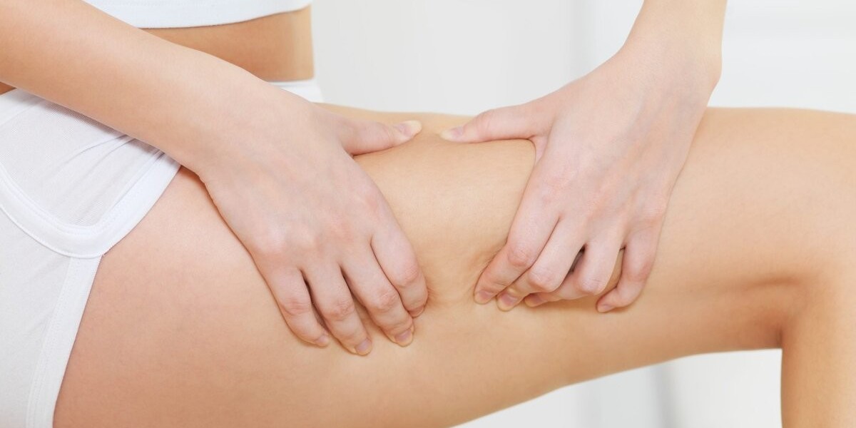 Why Should I Research Clinics Before Cellulite Treatment?