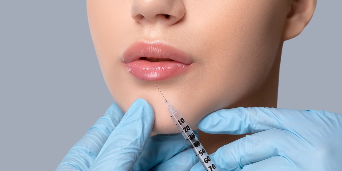 Best Lip Filler Injections in Dubai – Cost, Procedure, and Results