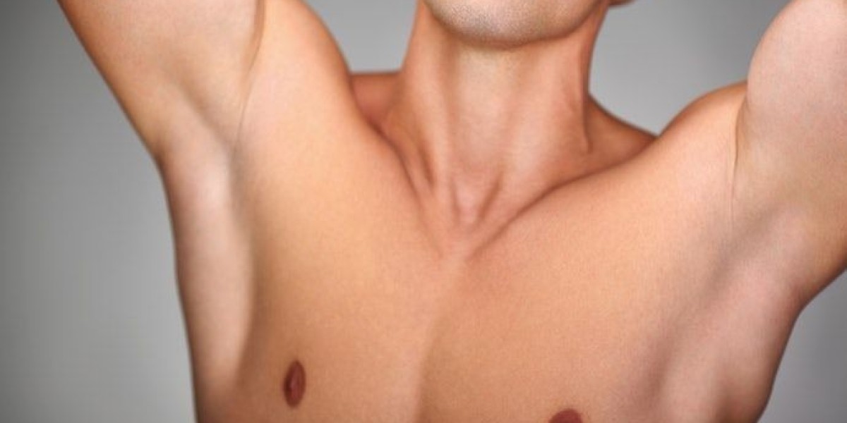 Post-Surgery Care for Gynecomastia in Riyadh