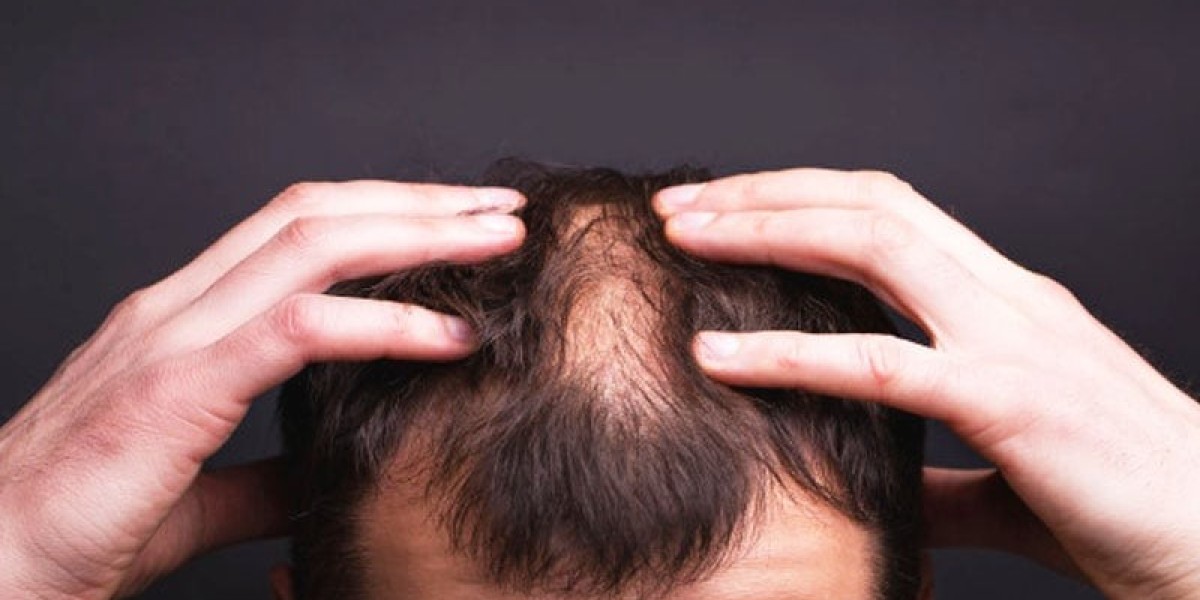 Can Hair Loss Treatments Increase Hair Thickness Fast?