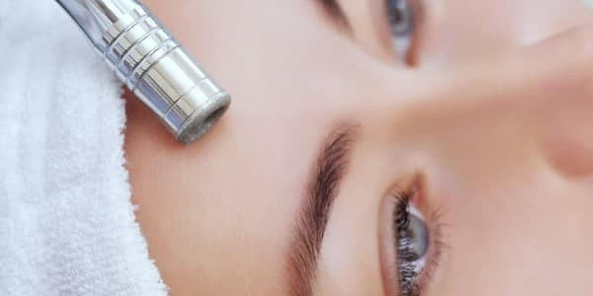 Do Diamond Peels Work for Pigmentation and Dark Spots?