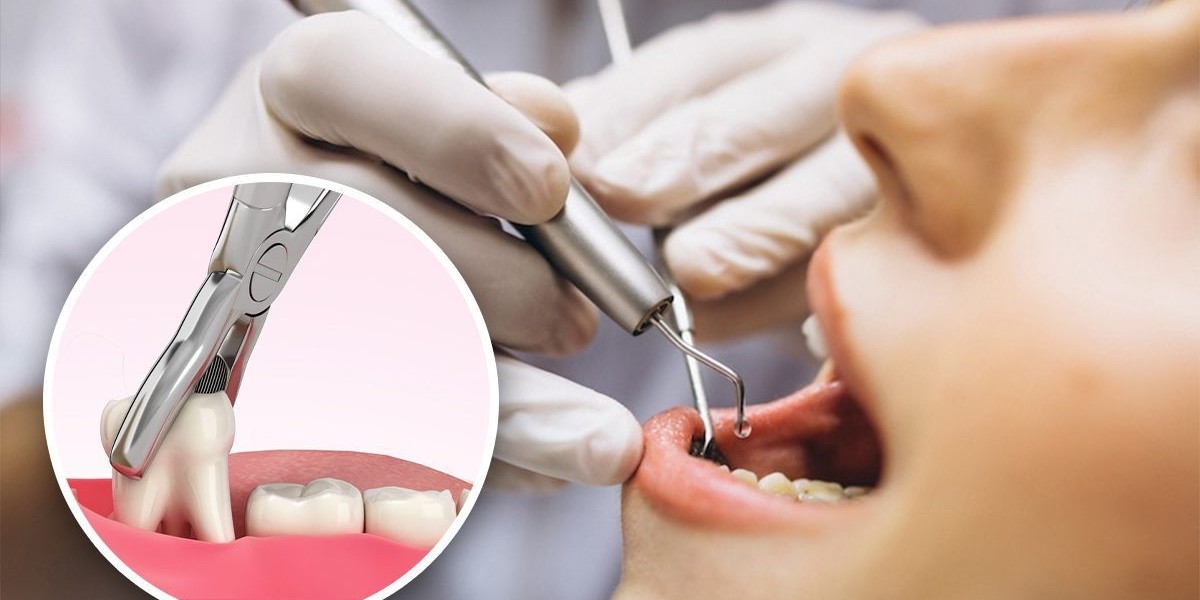 Unexpected Add-Ons That Increase Your Tooth Extraction Cost