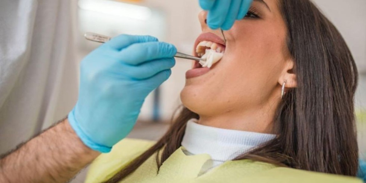 Can Tooth Extraction Cost Be Reduced with Early Treatment?