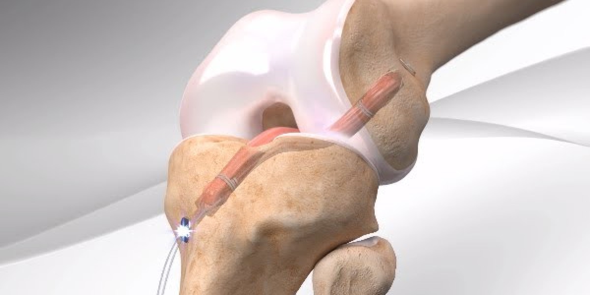 Emerging Growth and Strategic Insights in the Anterior Cruciate Ligament Injuries Market