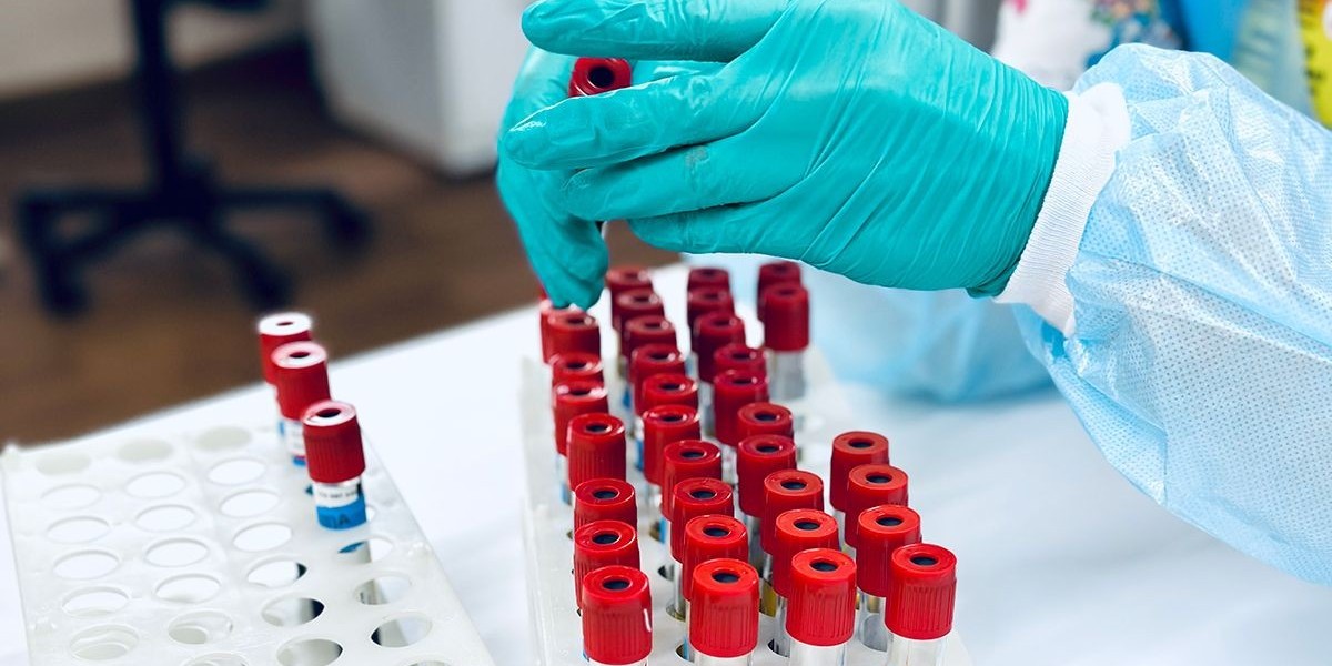 Blood Test at Home for Oxidative Stress: Key Markers