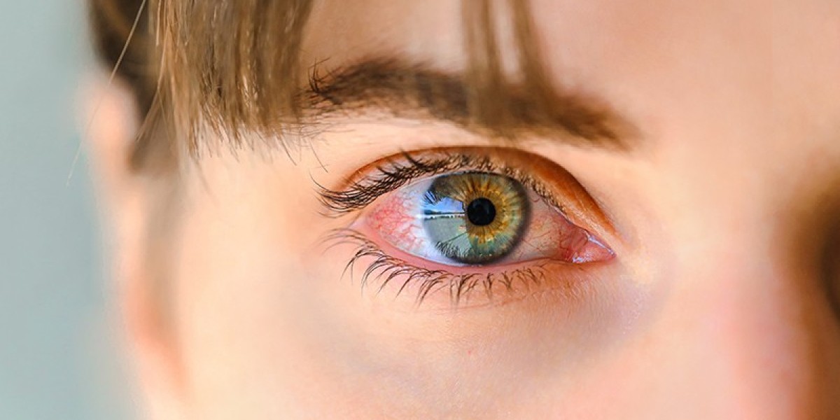 Presbyopia Treatment Market Size, Trends, and Strategic Outlook 2025-2032