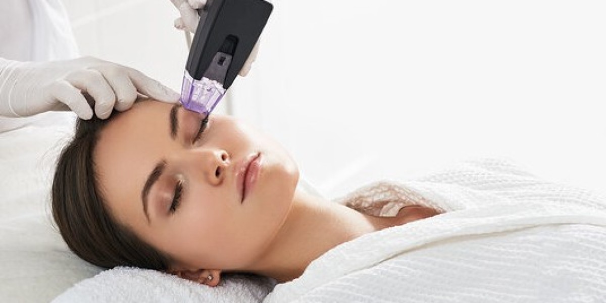 Transform Your Skin with Radiofrequency Microneedling at Aesthetics & Wellness by Monic Menard