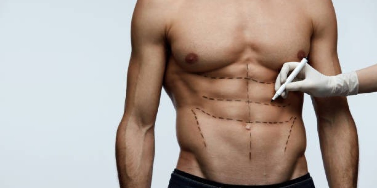 The Psychological Benefits of Undergoing Liposuction