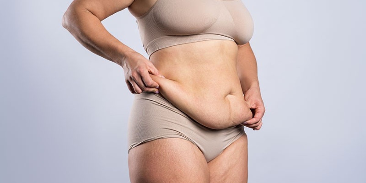 Can Tummy Tuck Surgery Correct a Hanging Belly Pouch?