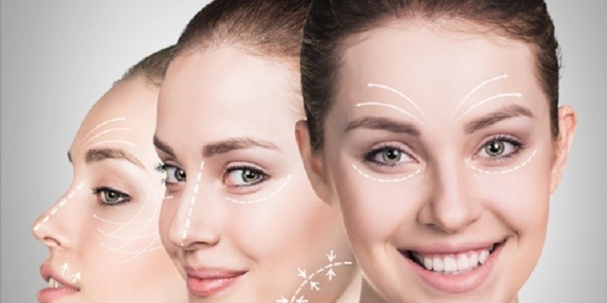 Facelift Surgery: Precision Techniques for Youthful Skin