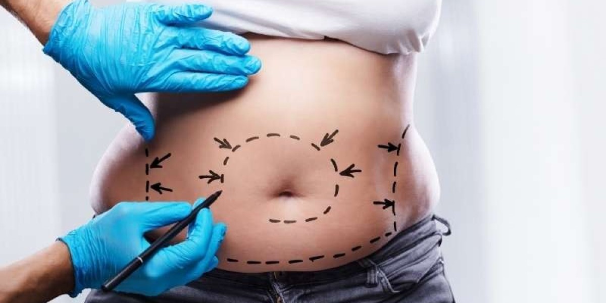 How Tummy Tuck Surgery in Dubai Boosts Your Self-Esteem