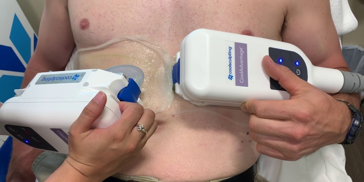Can CoolSculpting Sculpt Your Waistline in Weeks?