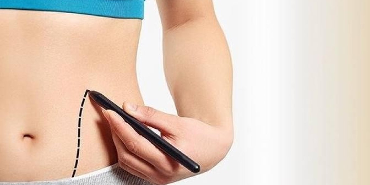 How Technology Is Shortening Recovery Time After Liposuction Surgery in Dubai