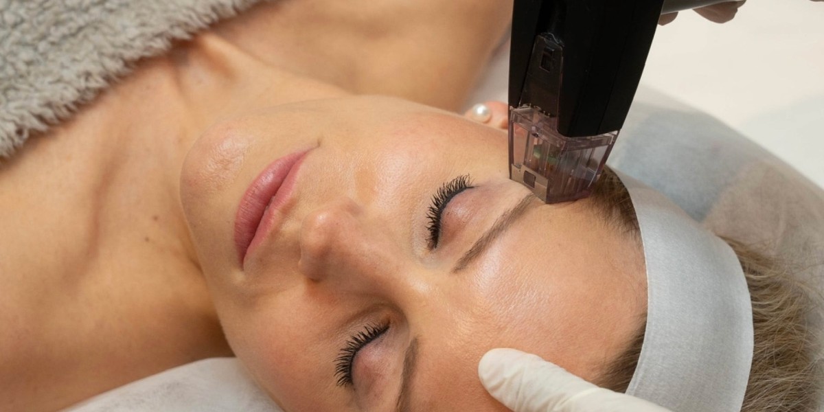 Morpheus8 Shapes the Skin Glow You Have Dreamed About
