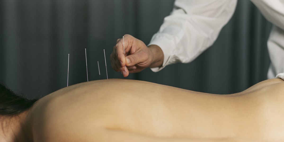 Discover Effective Calgary Acupuncture at Sincere Clinic