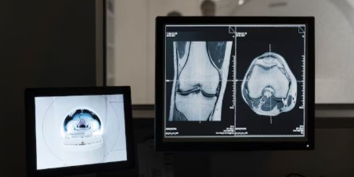 2025-2033년 한국 디지털 X-ray 시장 규모, 점유율 및 성장