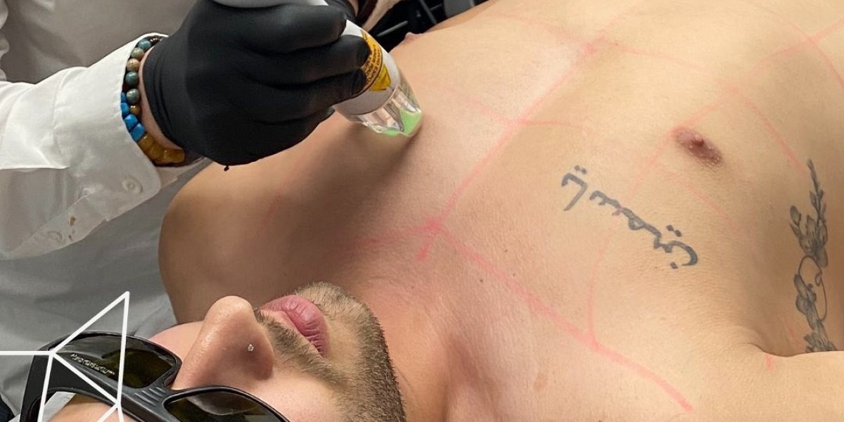 Male Laser Hair Removal Sydney – Smooth, Confident, and Hassle-Free
