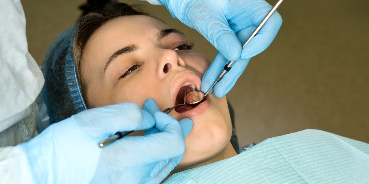 Is Tooth Extraction Cost Higher When Multiple Teeth Go?