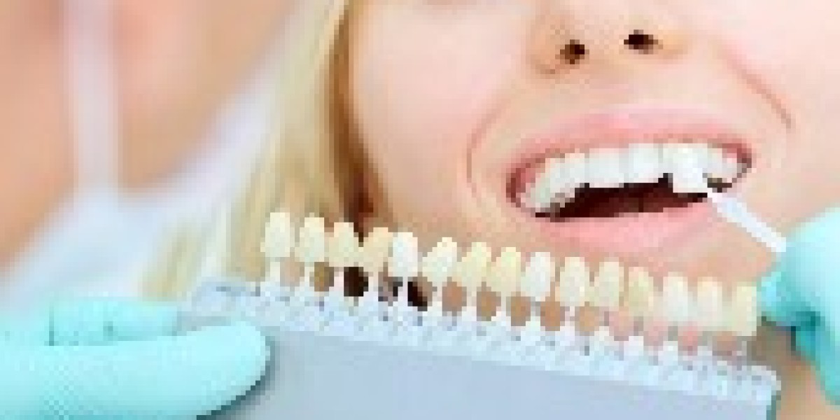 Achieve Your Brightest Smile with Professional & Natural Teeth Whitening in Australia