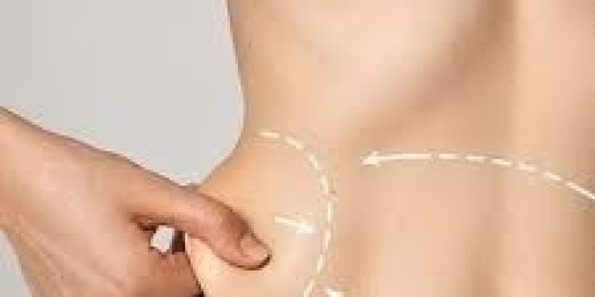 Abdominoplasty in Islamabad – Achieve a Flatter, Firmer Abdomen