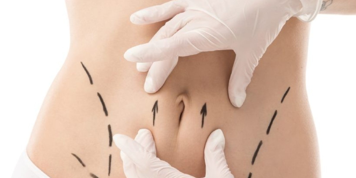 Does Tummy Tuck Surgery Help With Self-Confidence?