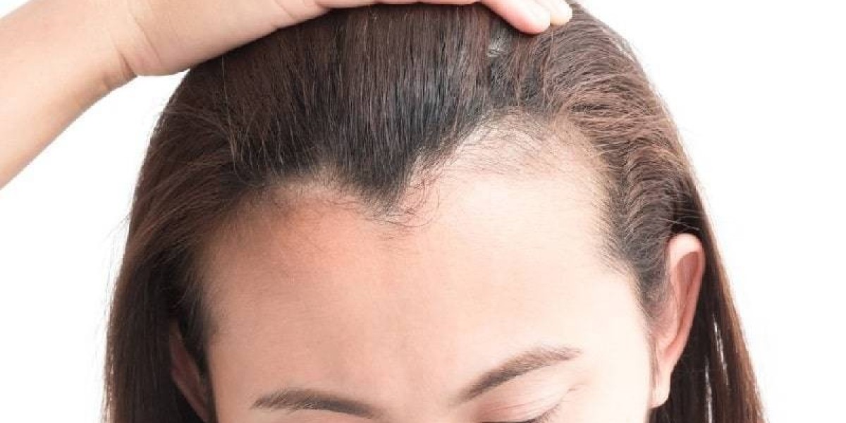 Can Hair Loss Treatments Really Restore My Hairline?