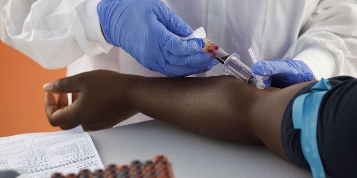 How IV Drip Supports Natural Detox Processes