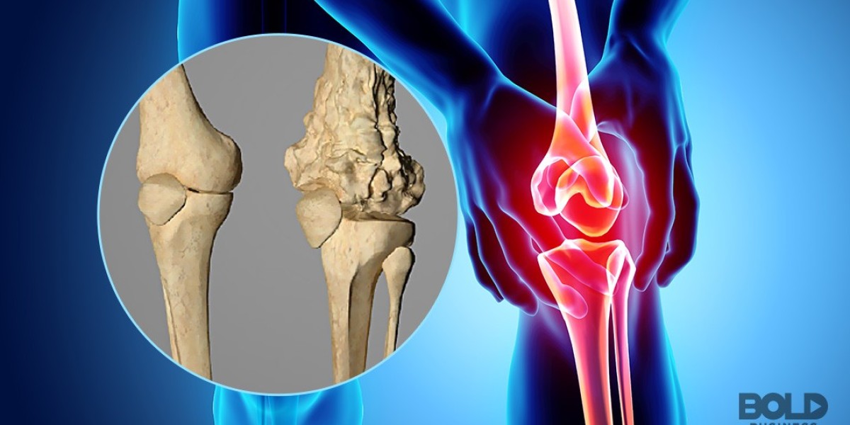 Osteosarcoma Treatment Market: Strategic Analysis & Growth Outlook 2025-2032