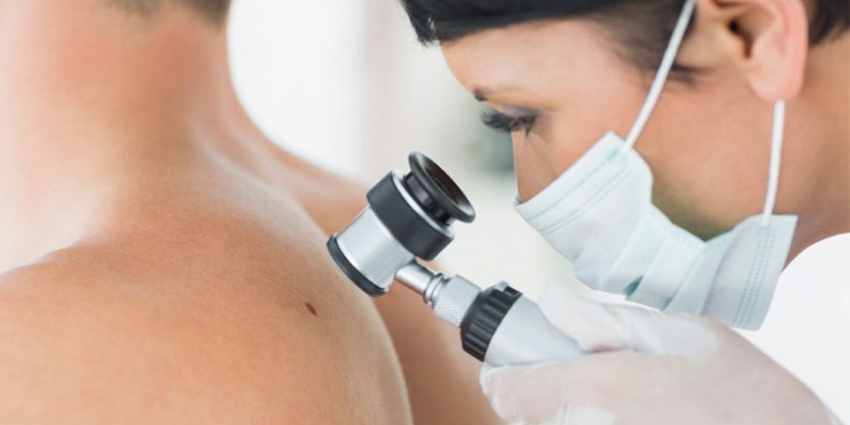 What the Best Dermatologist Wants You to Know About Peels