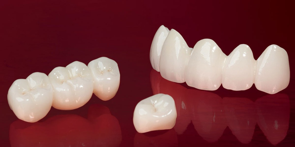 The Science Behind Zirconia Crowns: Strength and Beauty Combined