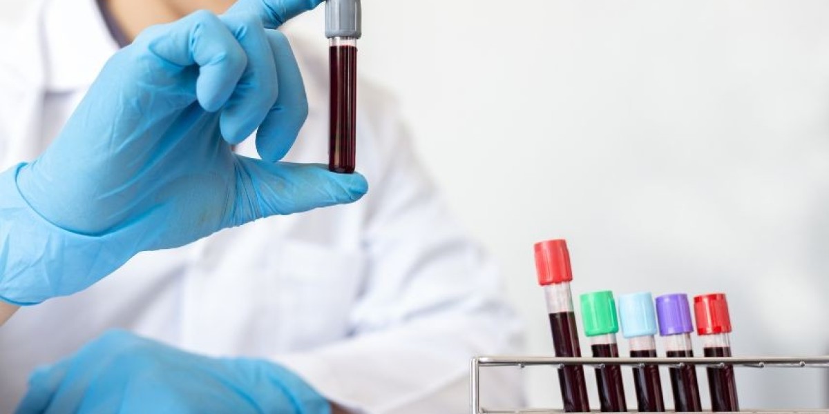 What to Expect If You Accidentally Eat Before a Fasting Blood Test