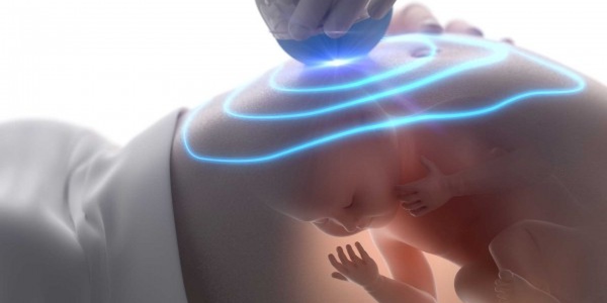 Understanding Ultrasound Machine Cost: A Complete Guide for Healthcare Providers