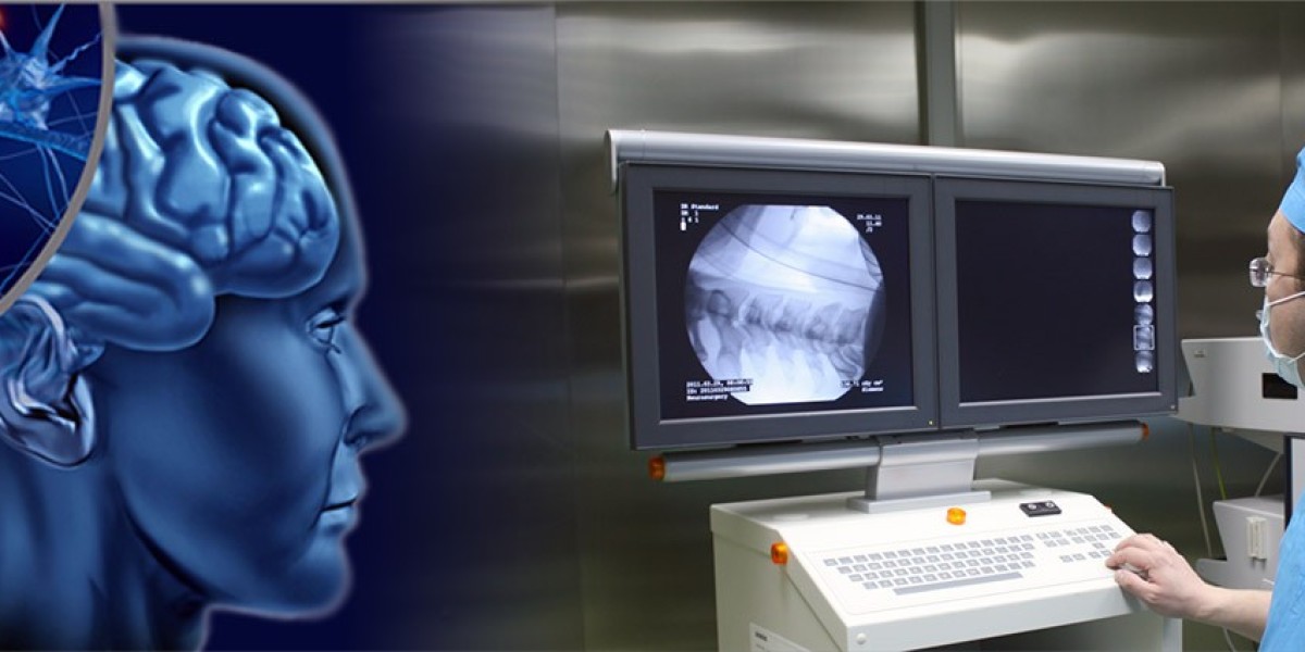 Neurointerventional Devices Market Insights Revealing Growth Potential in Stroke and Aneurysm Solutions