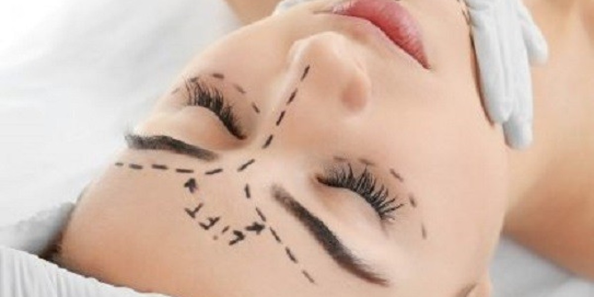 Facelift Surgery: Safe and Effective Rejuvenation