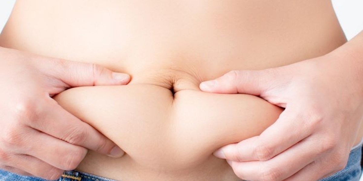 Managing Side Effects After Liposuction and Tummy Tuck in Riyadh