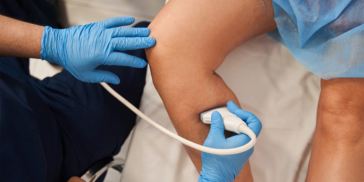 Blood Test at Home for Detecting Blood Clotting Disorders