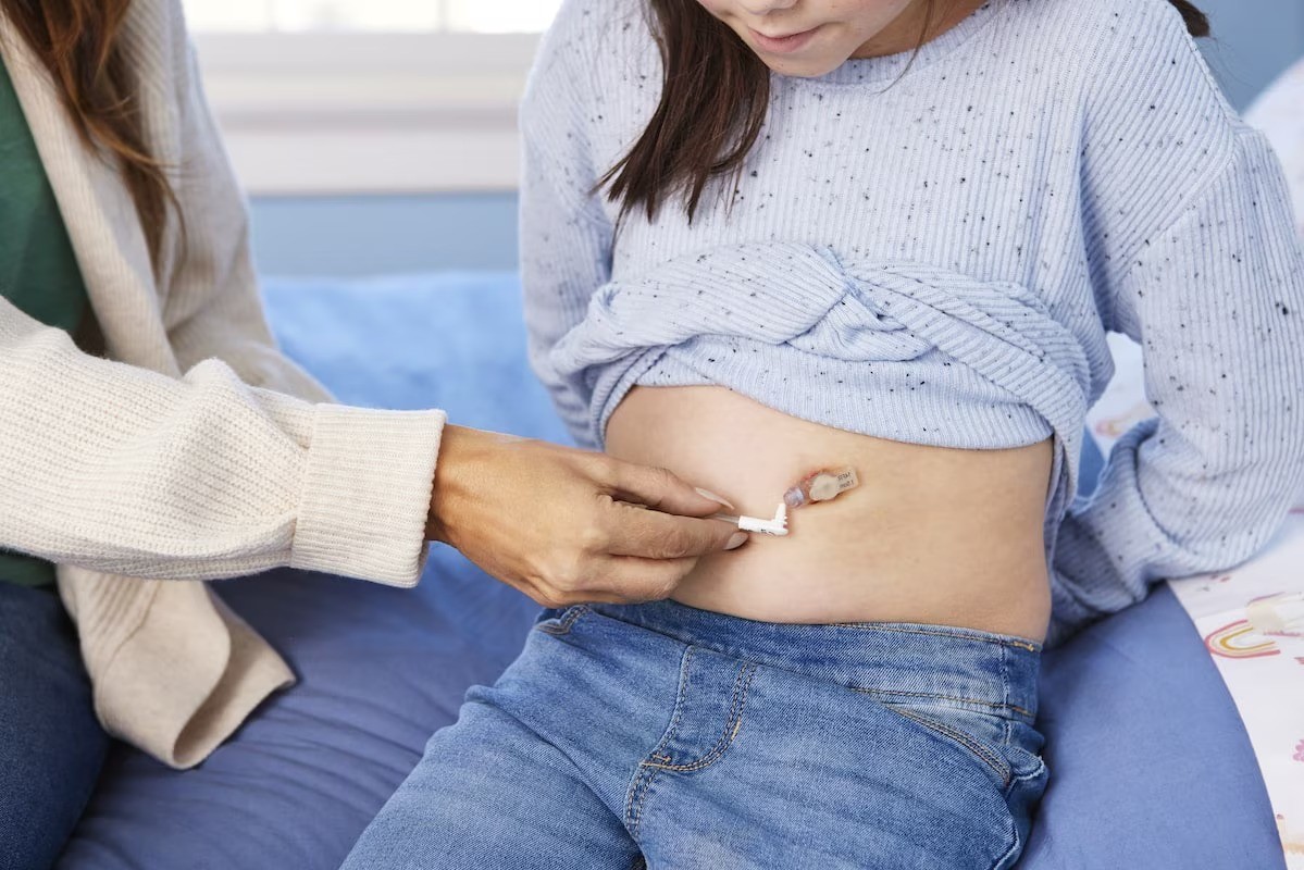 Tube Feeding at home
