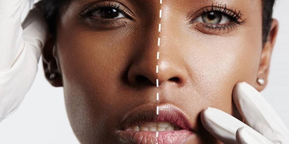 Will My Skin Darken Again? Maintaining Whitening Results in Islamabad