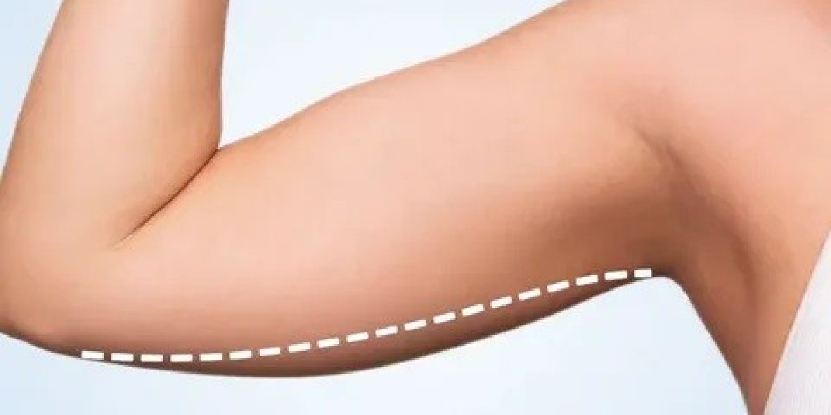 Arm Lift Surgery in Islamabad: Minimizing Scars