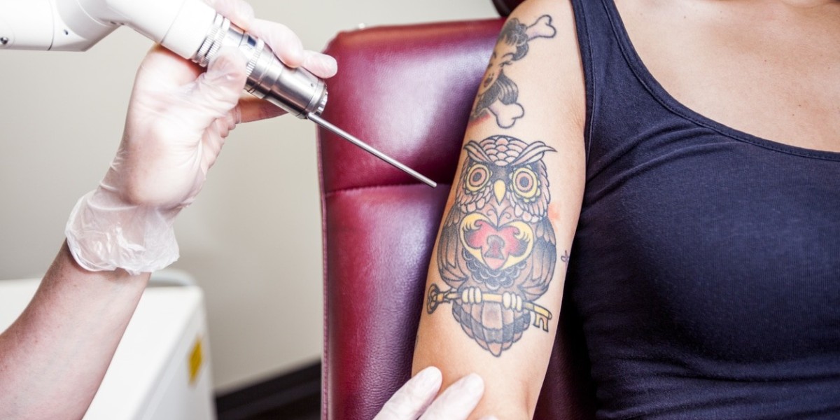 Does PicoSure Laser Tattoo Removal Work on All Inks?