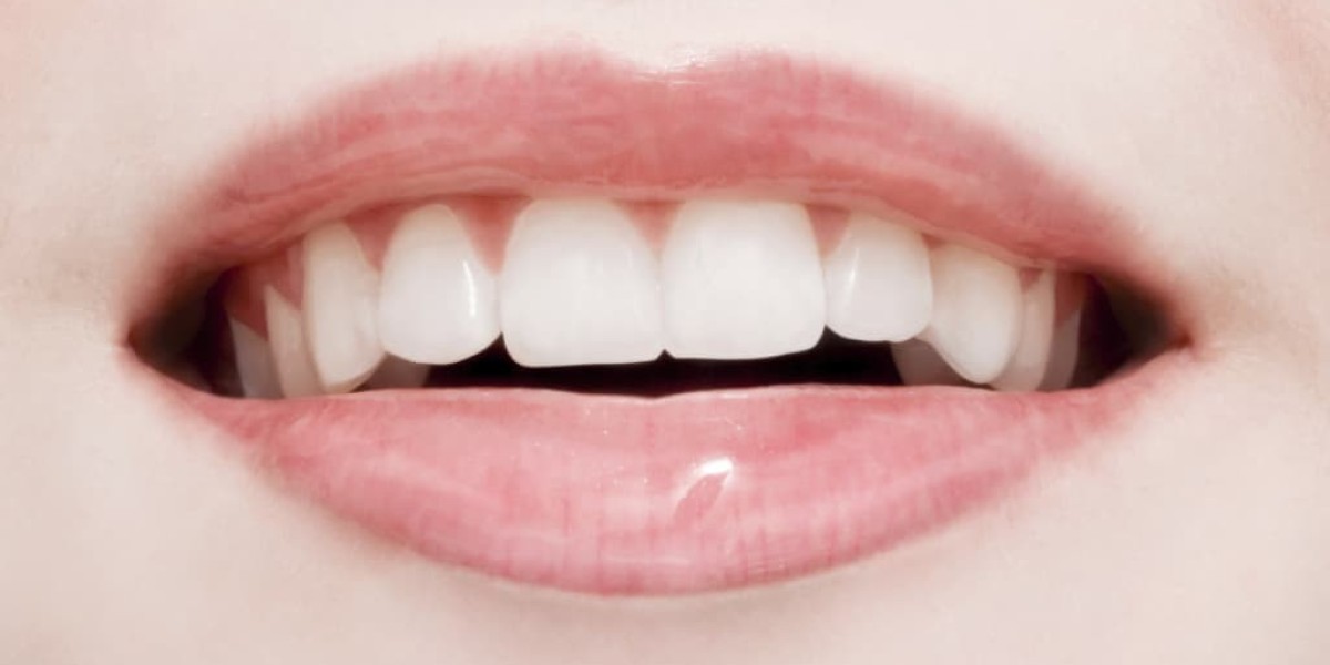 The Pros and Cons of Composite Bonding You Must Know