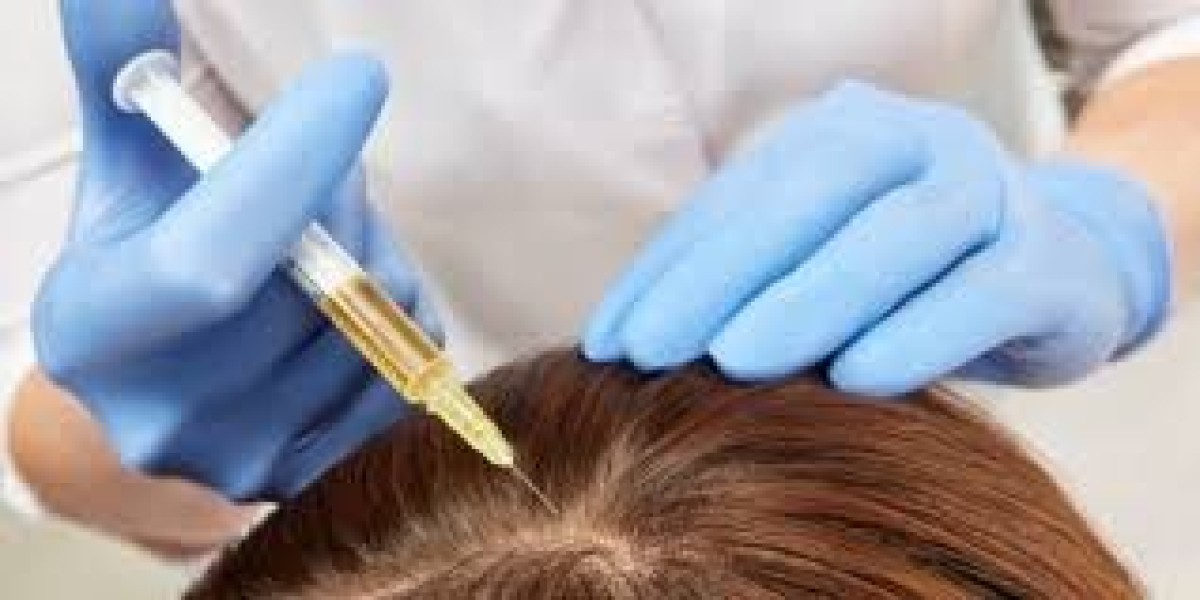 What Is the Best PRP Hair Treatment for Baldness?