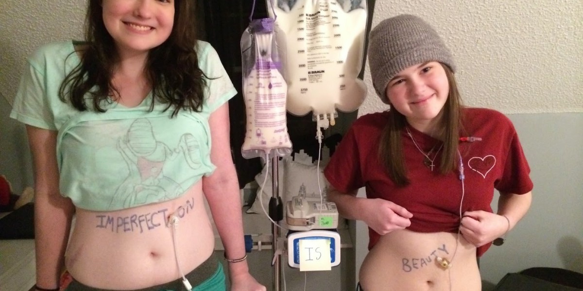 Tube Feeding at Home: What to Know