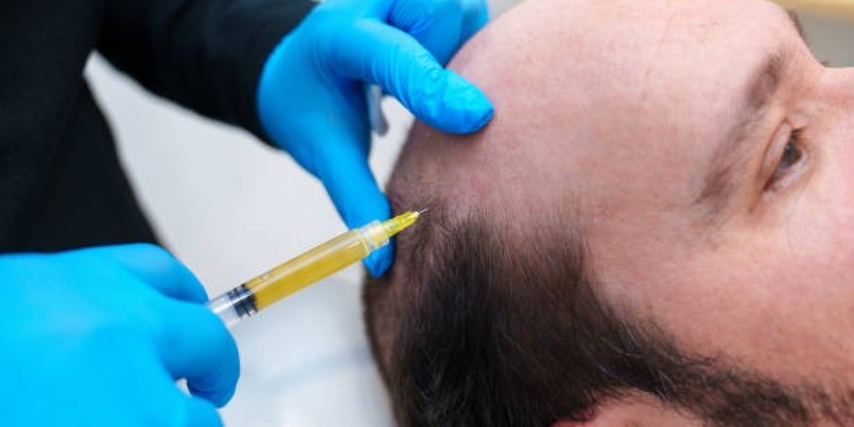 PRP Hair Treatment in Dubai: Ideal Candidates for This Therapy