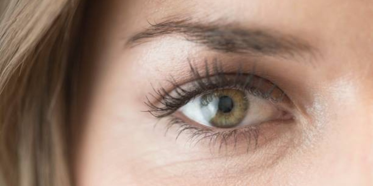Eyelid Surgery in Riyadh – A Smart Choice for Eye Rejuvenation