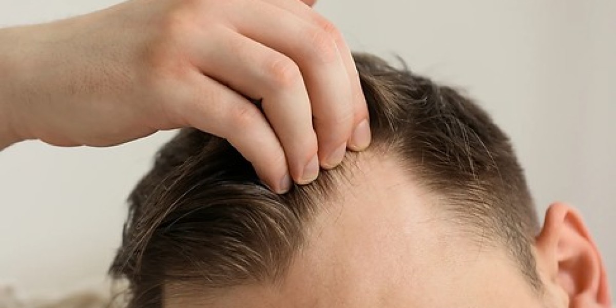 Is FUT Hair Transplant Safe for All Hair Types?