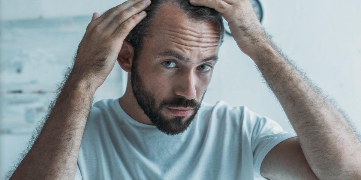 Can I Buy Finasteride 1mg Without a Prescription?