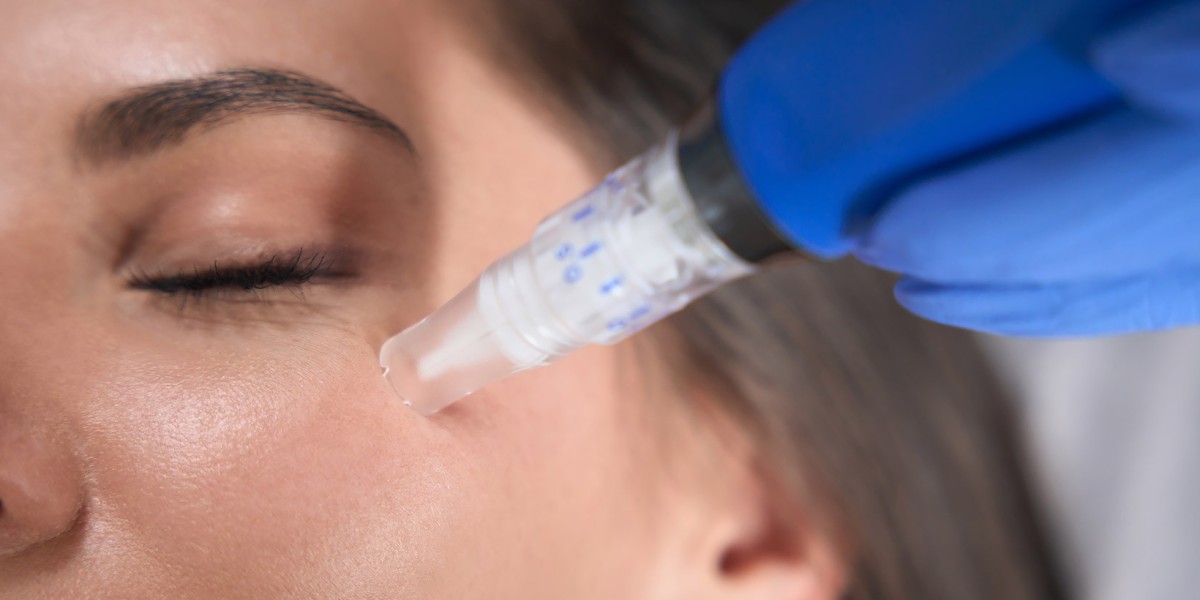 Youthful Skin Awaits: Explore Microneedling Treatments in Dubai