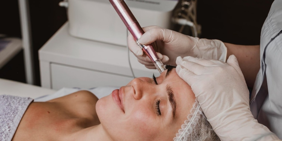 How Can Microneedling Treat Hyperpigmentation?